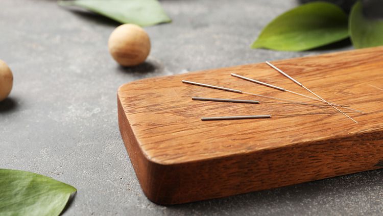 8 Things to Expect From Your First Acupuncture Experience