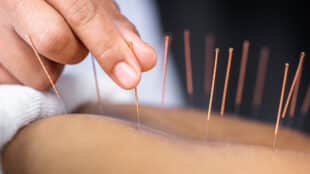 3 Steps to Reduce Missed Appointments in Your Acupuncture Practice